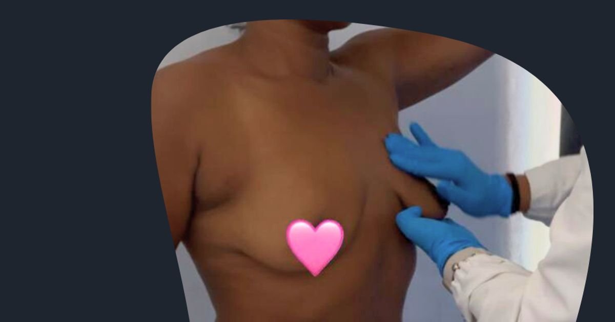 Rastreio ao Cancro da Mama